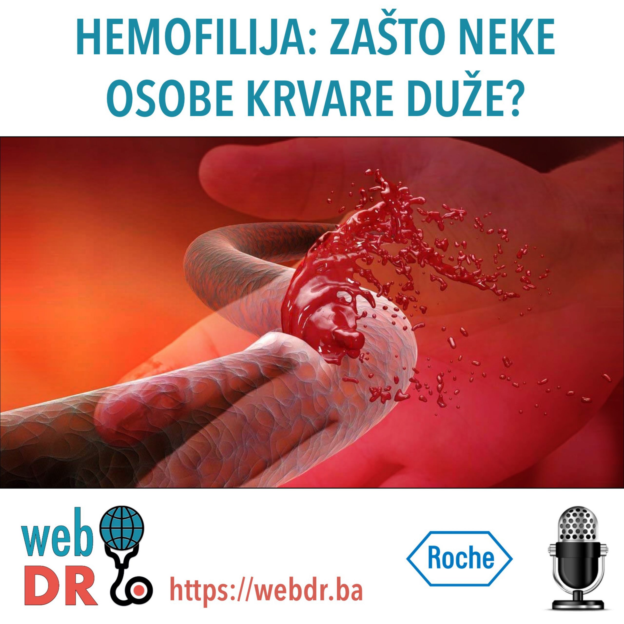Hemofilija: zašto neke osobe krvare duže?